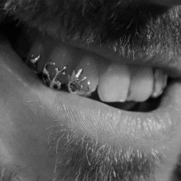 Custom Grillz Organic #1