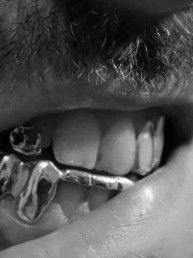Custom Grillz Organic #2