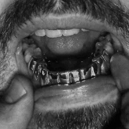 Grillz Lower bottom Full Set