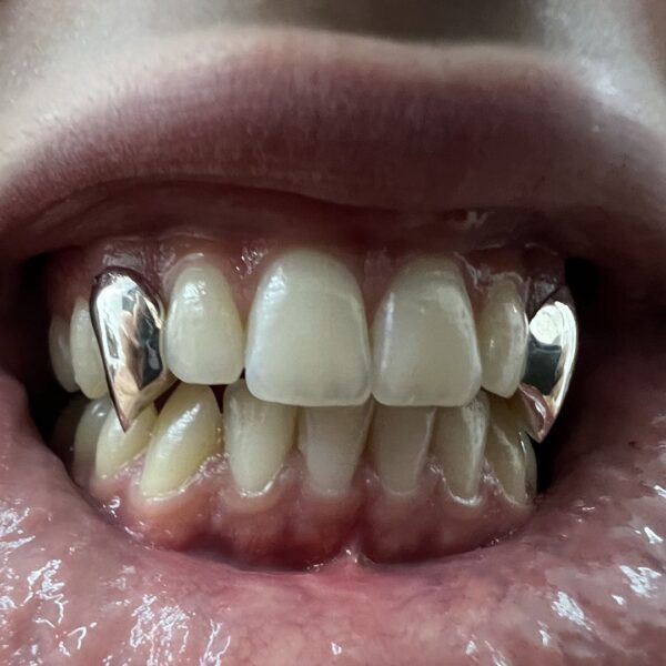 Custom Grillz Full Fangs
