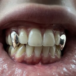 Custom Grillz Full Fangs