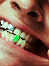 Custom Grillz Color Caps