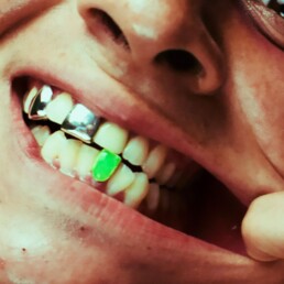 Custom Grillz Color Caps