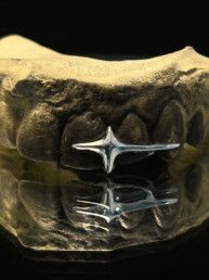 Grillz Shooting Star