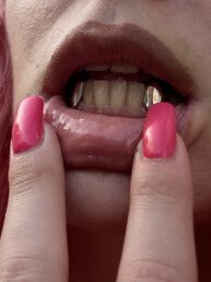 Lower fangs