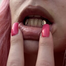 Lower fangs