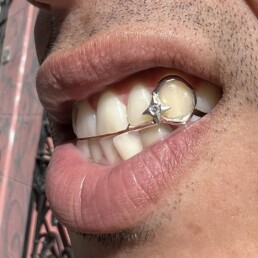Star open face