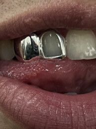 Grillz Full + Open Combo